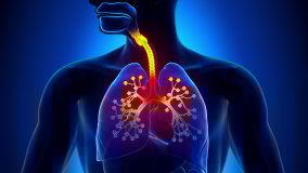 Bronchiolitis - Inflammation of the Bronchioles - in 4K resolution